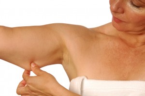 Lifting des des bras à Lyon - Chirurgie esthétique lifiting