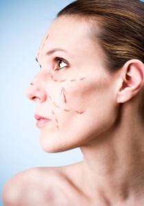 Injection Botox acide hyaluronique à Lyon - Comblement rides & lèvres